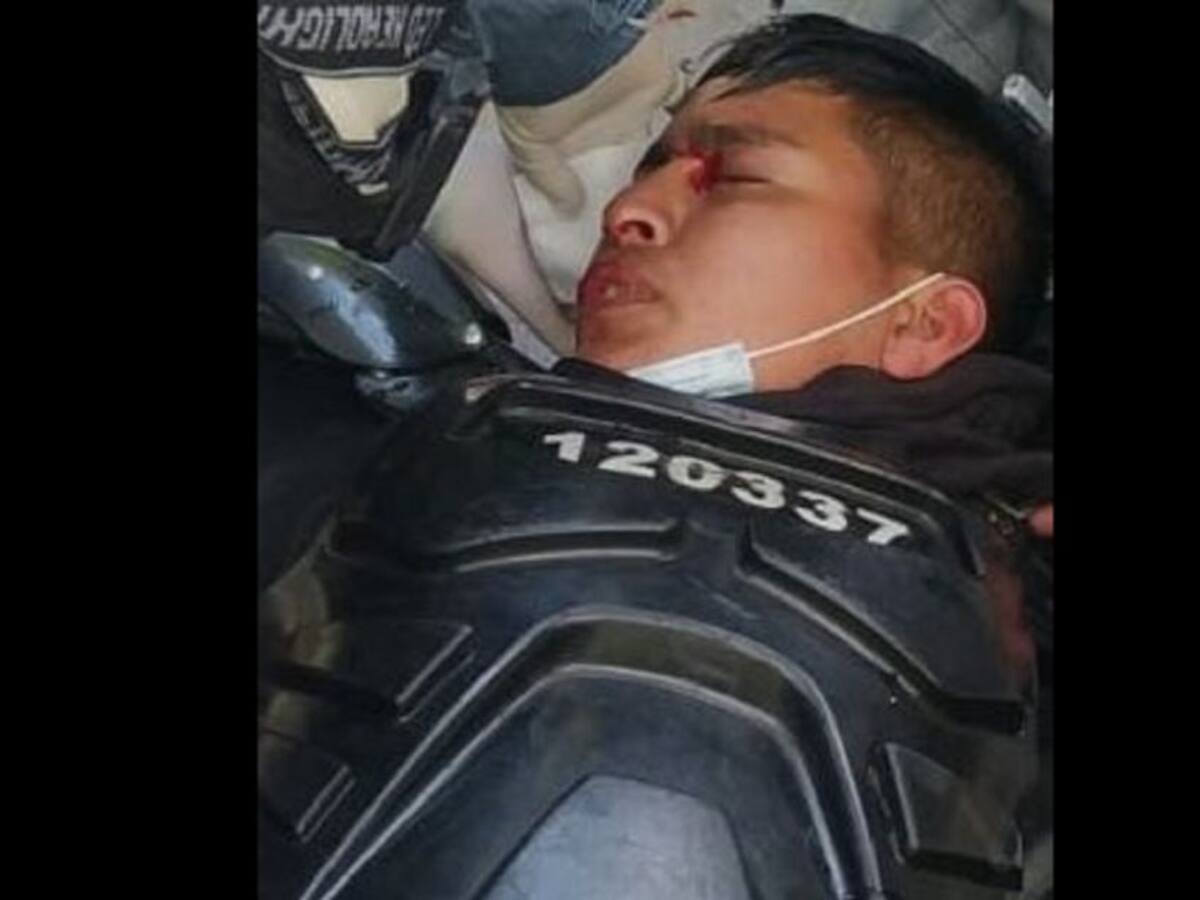 Policía resultó herido en uno de sus ojos en Bogotá