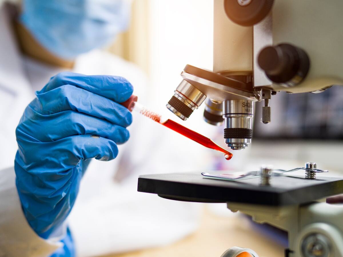 Casos de VIH en Colombia aumentaron un 13% en el último año