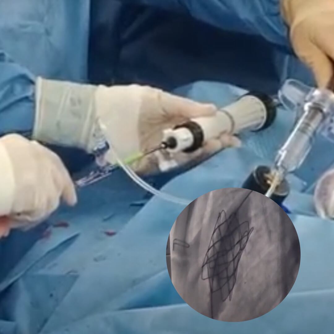 Foto: cortesía Clínica Cardio VID.