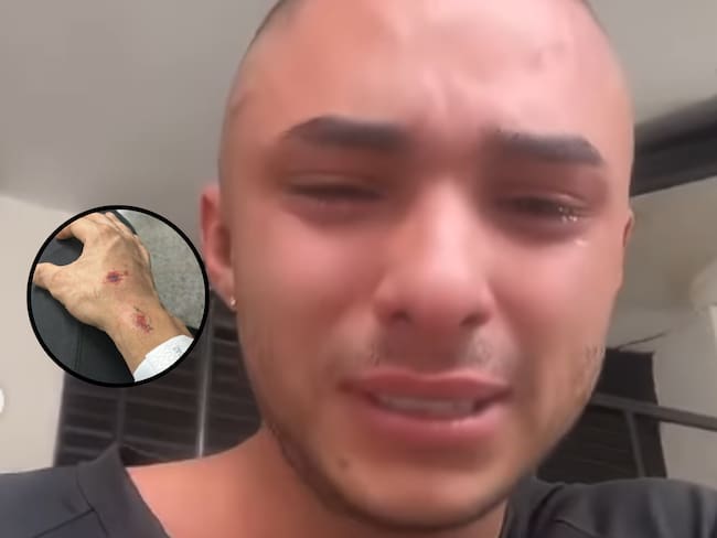 Pareja gay denunció ser víctima de un ataque de homofobia. Foto: Suministrada.