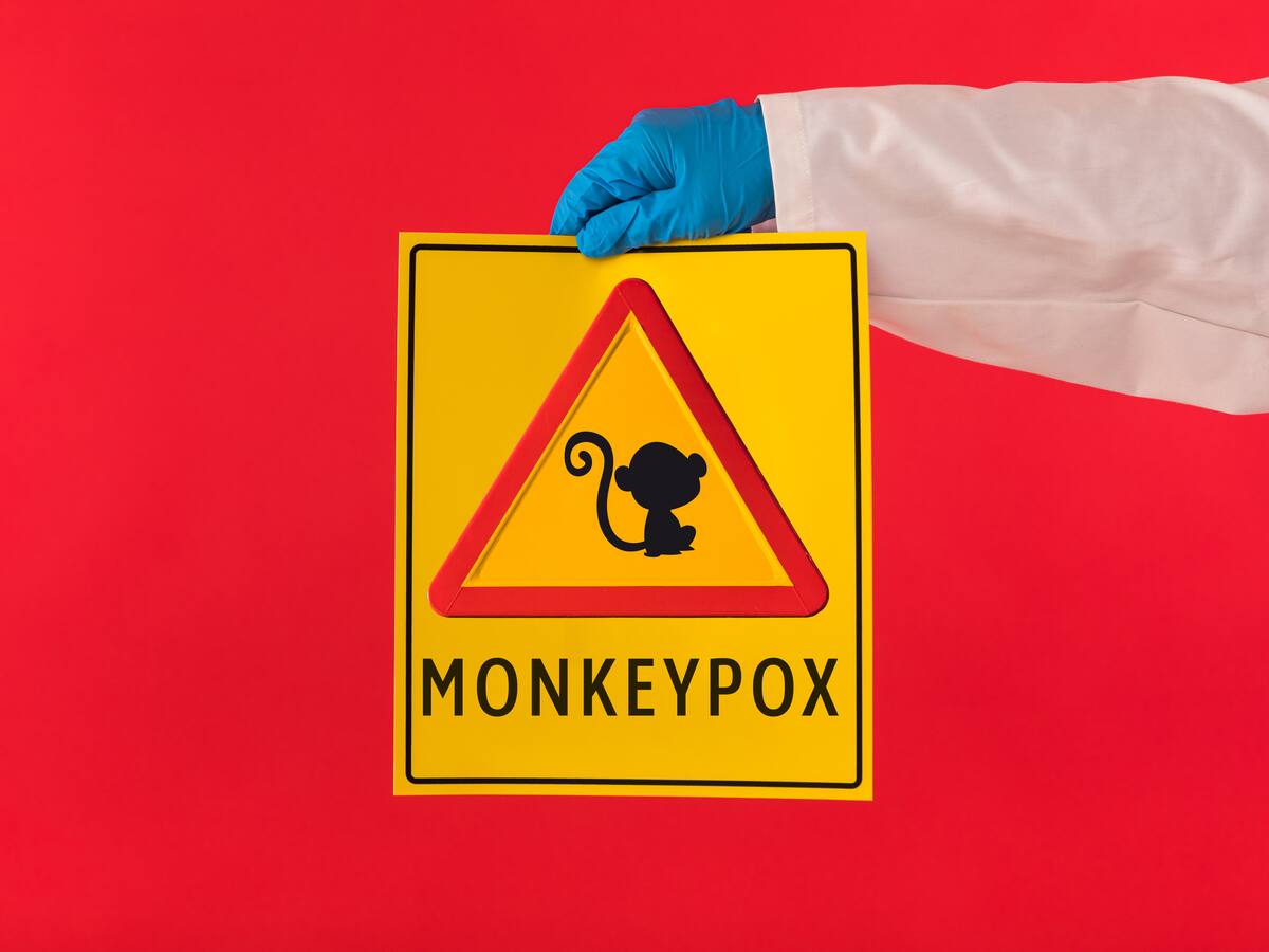 Reporte Viruela del Mono en Colombia y América Latina