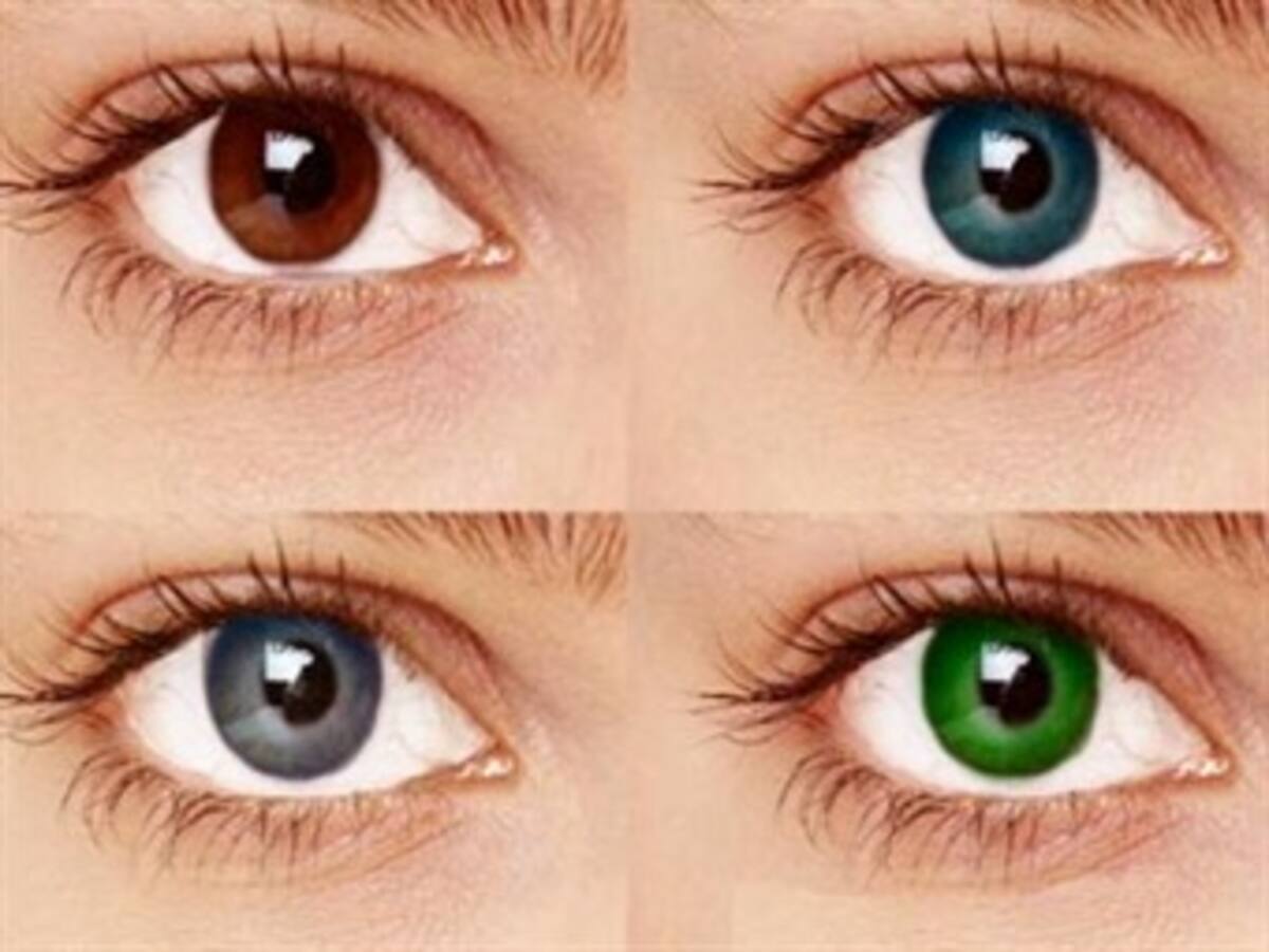 Con láser se puede cambiar el color de los ojos