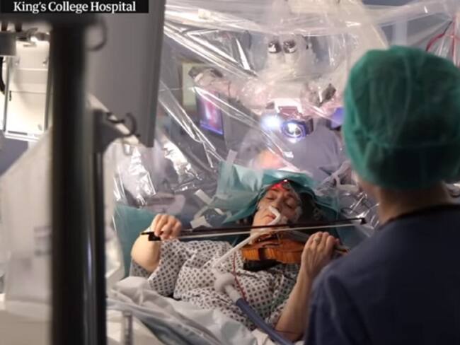 En video: ¡Increíble! Mujer toca el violín mientras la operan del cerebro