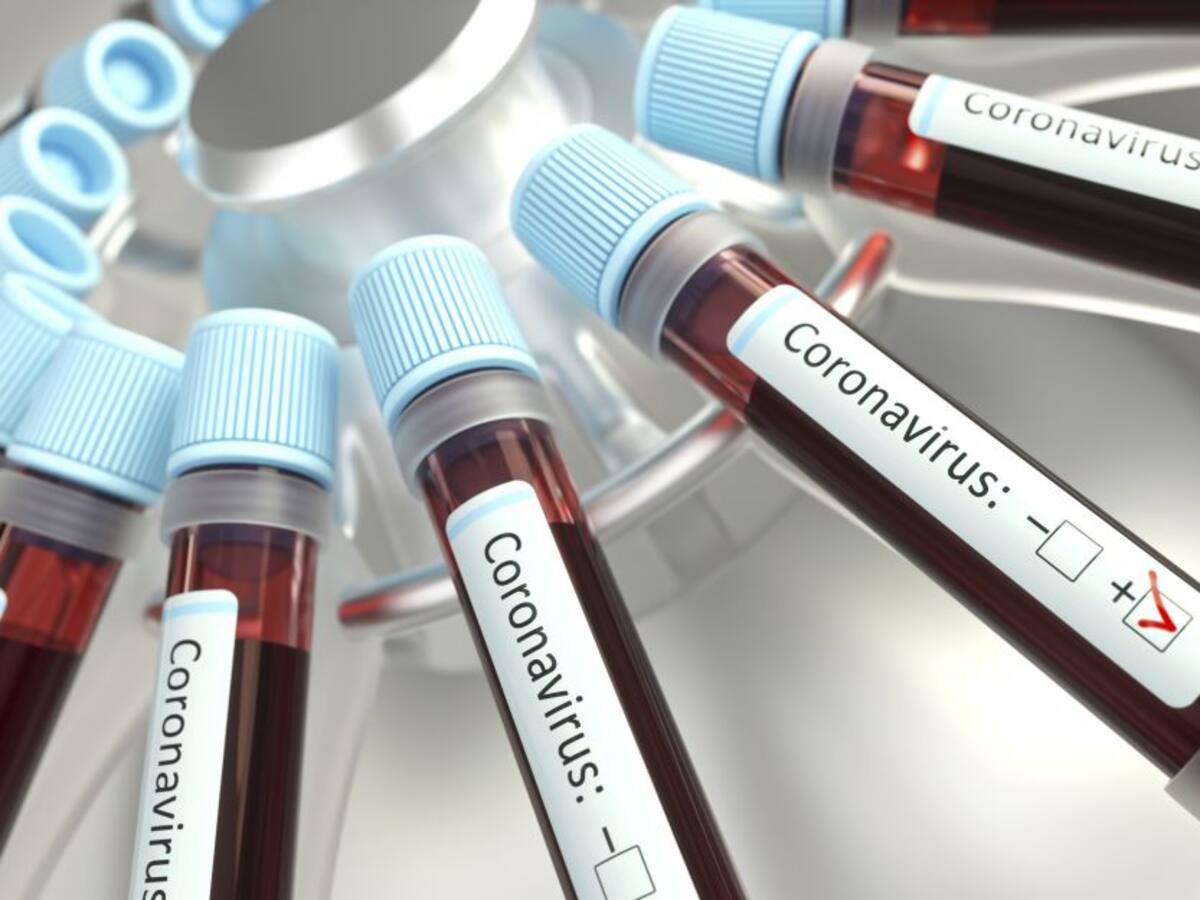 Colombia inició diálogos con Oxford y Pfizer para posible vacuna COVID
