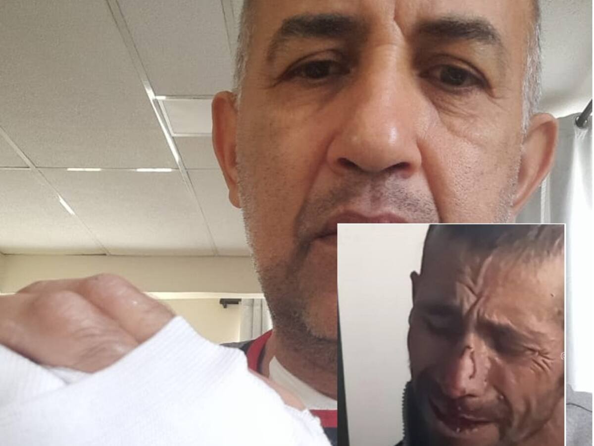 Envían a la cárcel al habitante de la calle que agredió a un comerciante en Armenia