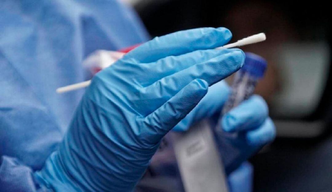 Realización de pruebas PCR