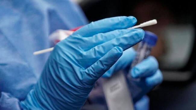 Realización de pruebas PCR