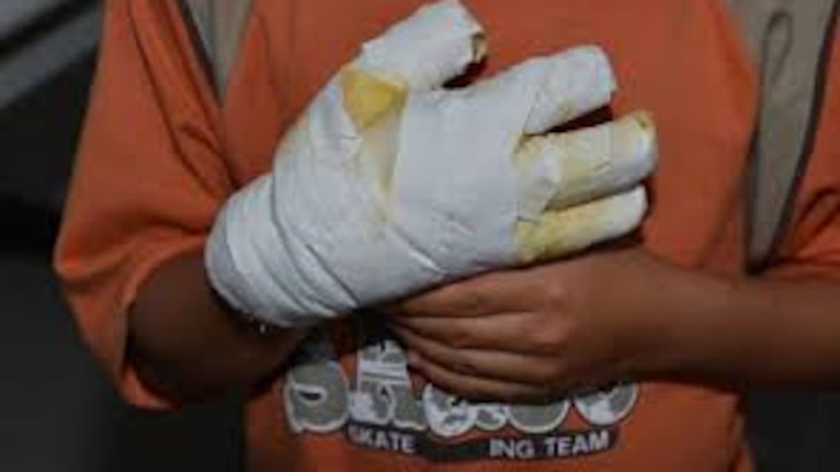 Ya son 30 los lesionados por el uso indebido de pólvora en el Valle, en apenas 9 días de diciembre