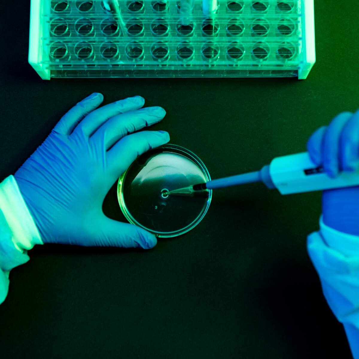 Brote de bacteria Klebsiella en hospital de Tunja: ¿es crítica la situación?