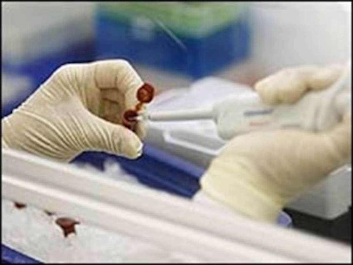 A siete se eleva el número de personas contagiadas con influenza tipo A en Colombia