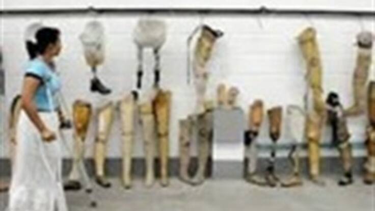 Donaciones que ayudan a seguir caminando por la vida