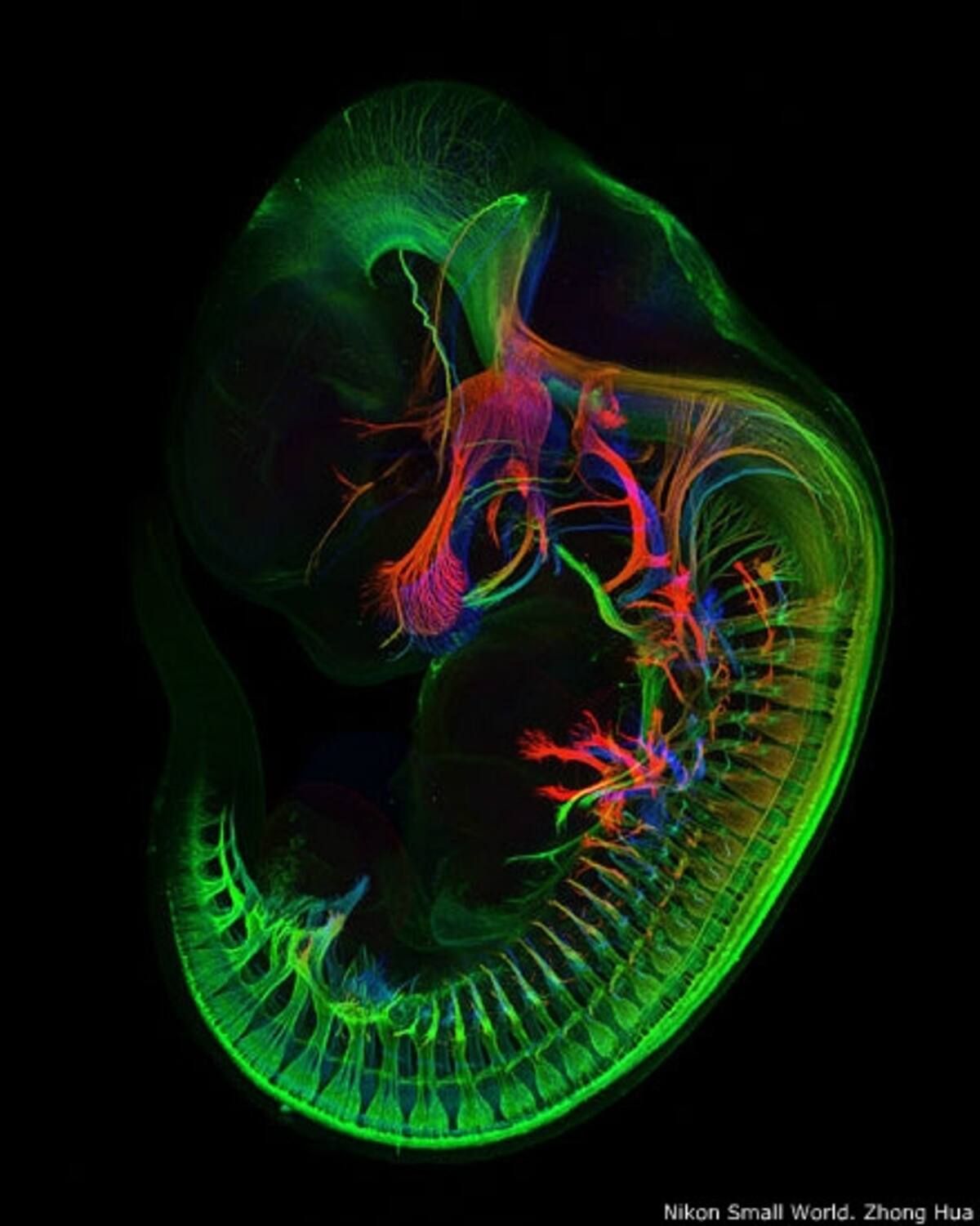 13º - Dr. Michael Paul Nelson y Samantha Smith, del Departamento de Patología/Neuropatología de la Universidad de Alabama (EE.UU). Imagen de una sección de la vértebra de un ratón.