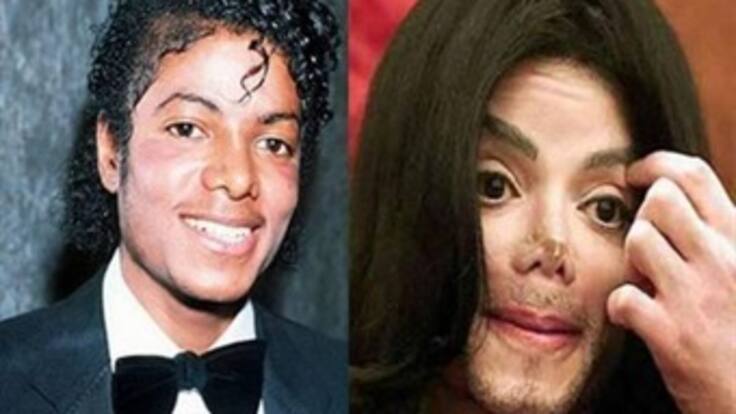 La cirugía estética entre la vanidad y la autoestima