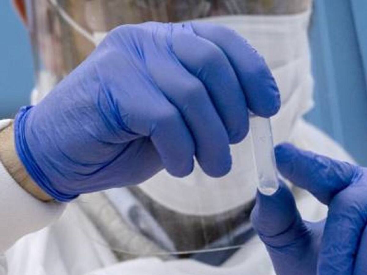 A 286 se eleva la cifra de casos activos de coronavirus en el Huila
