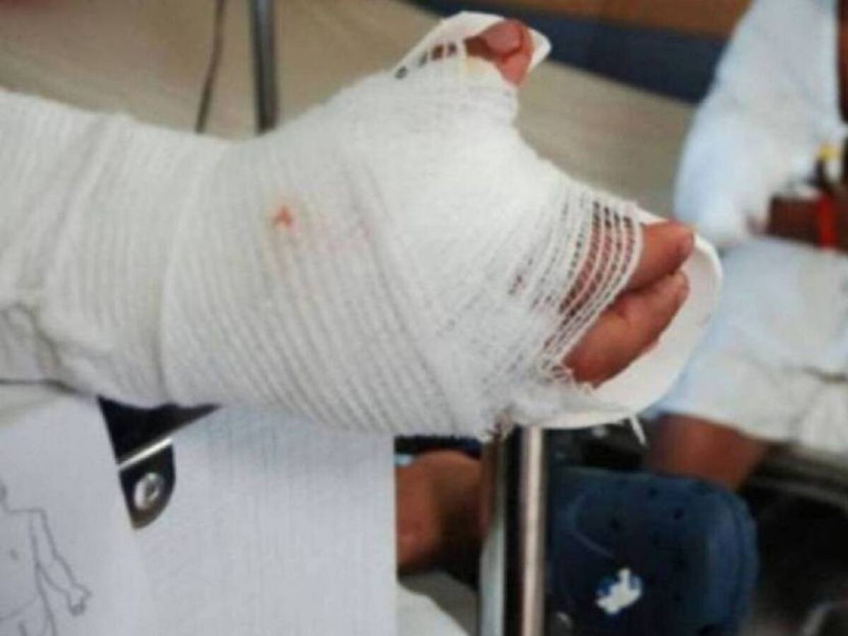 4 personas quemadas con pólvora en el Tolima en la noche de velitas