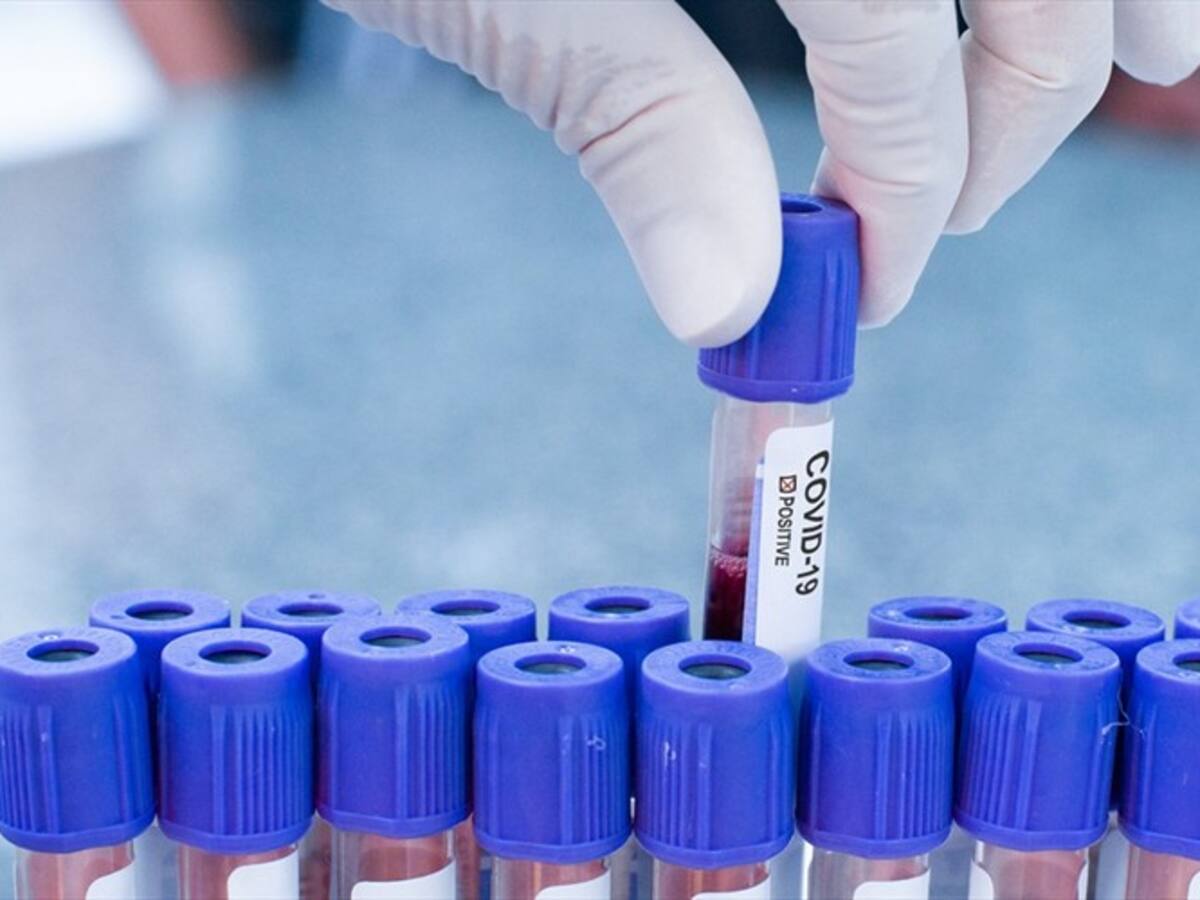 Gobierno español compró un millón de pruebas defectuosas para coronavirus