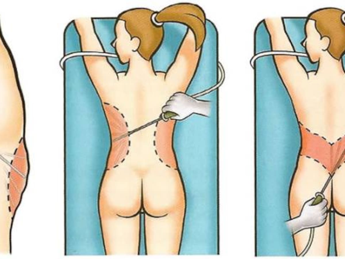 Condenan a dos médicos por mala práctica en cirugía estética