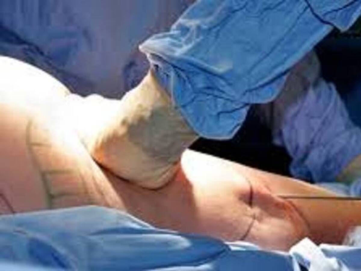 Murió en Cali norteamericana por cirugía estética