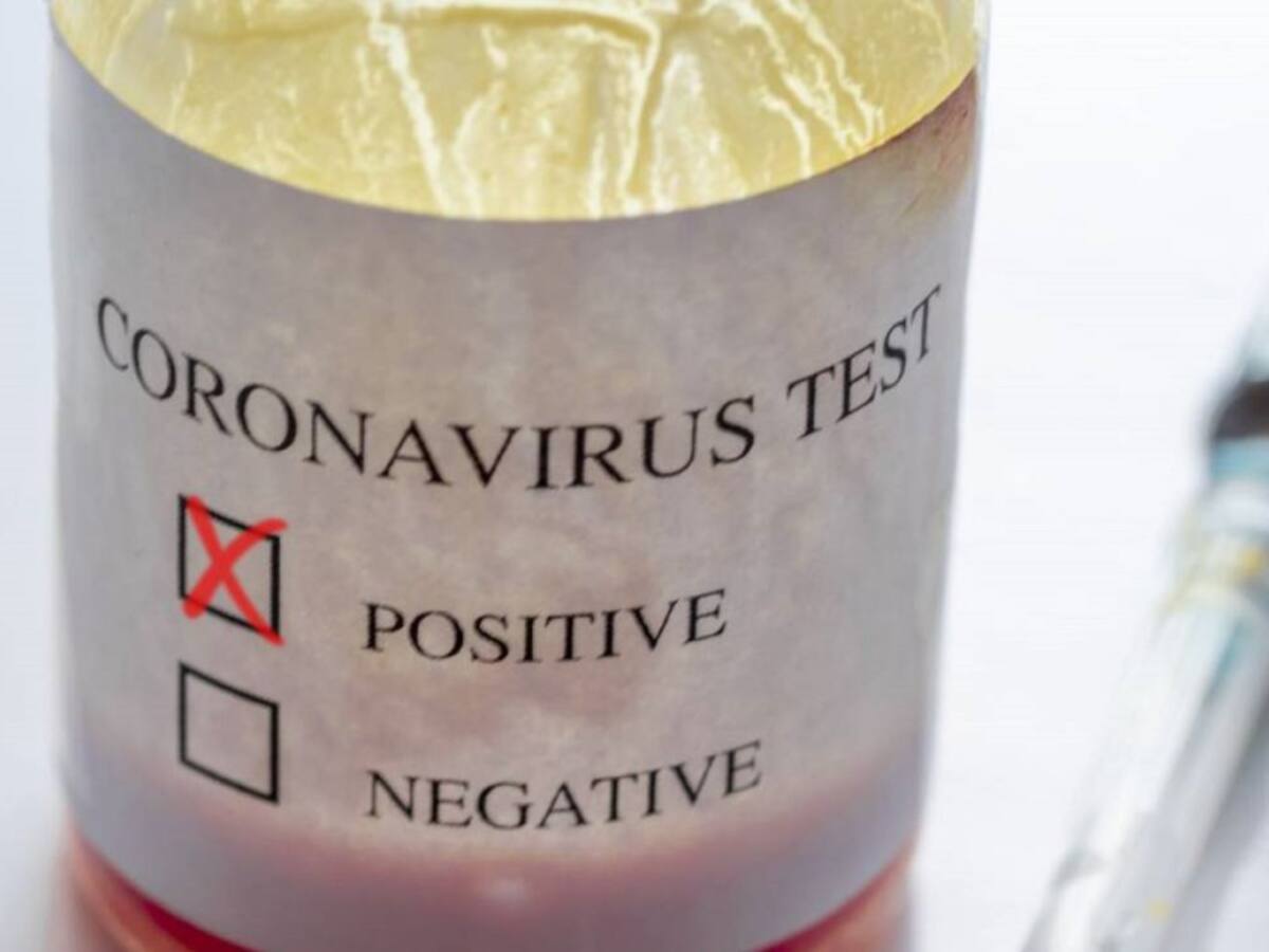 Autoridades sanitarias reportan solo 10 casos de coronavirus en la frontera