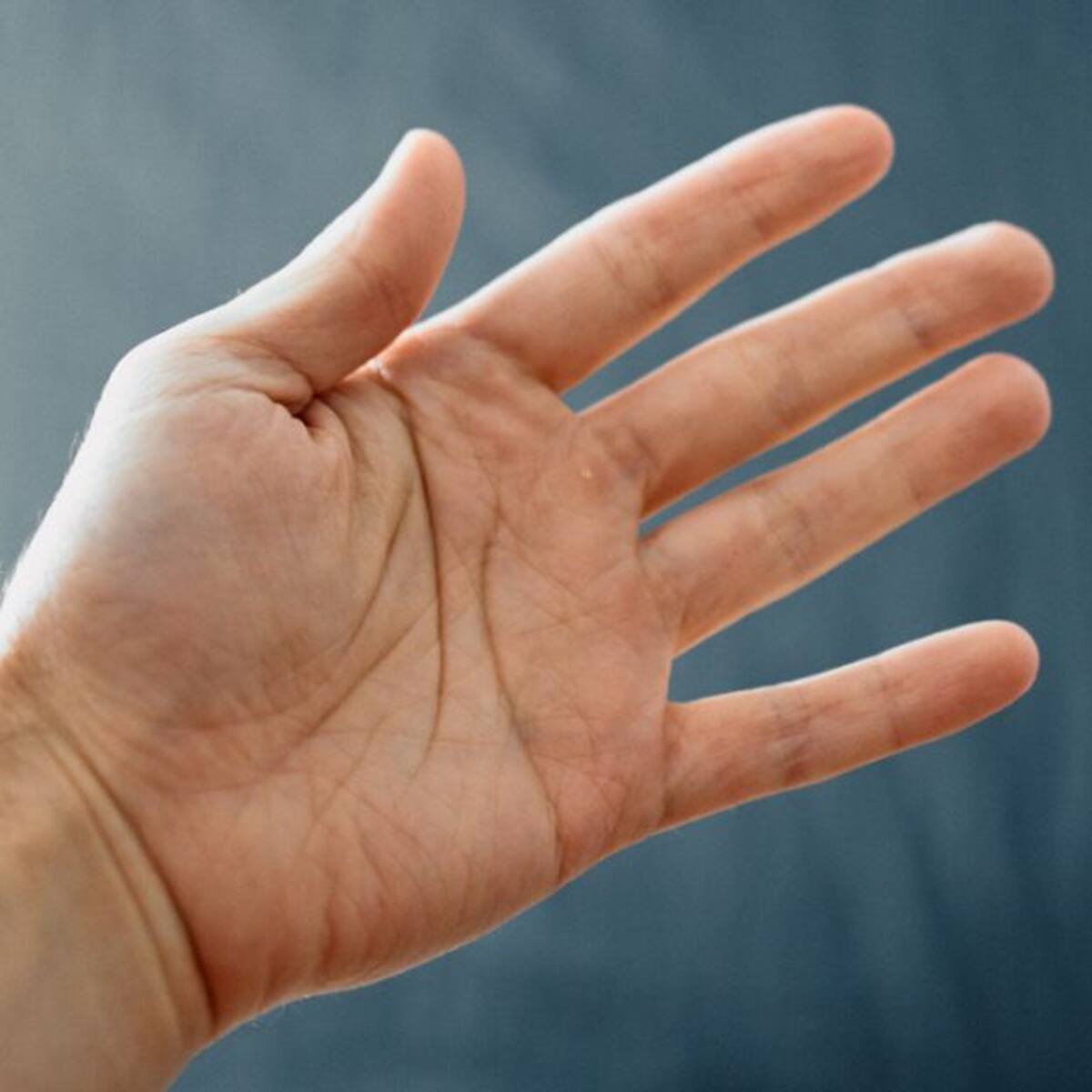 Hoy Día Mundial de la Esclerodermia