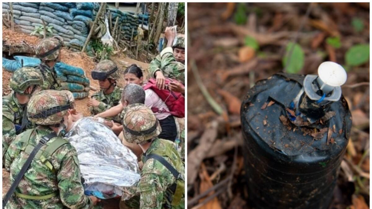 Concejal de Argelia, Cauca pierde su pierna derecha por una mina antipersonal de disidencias