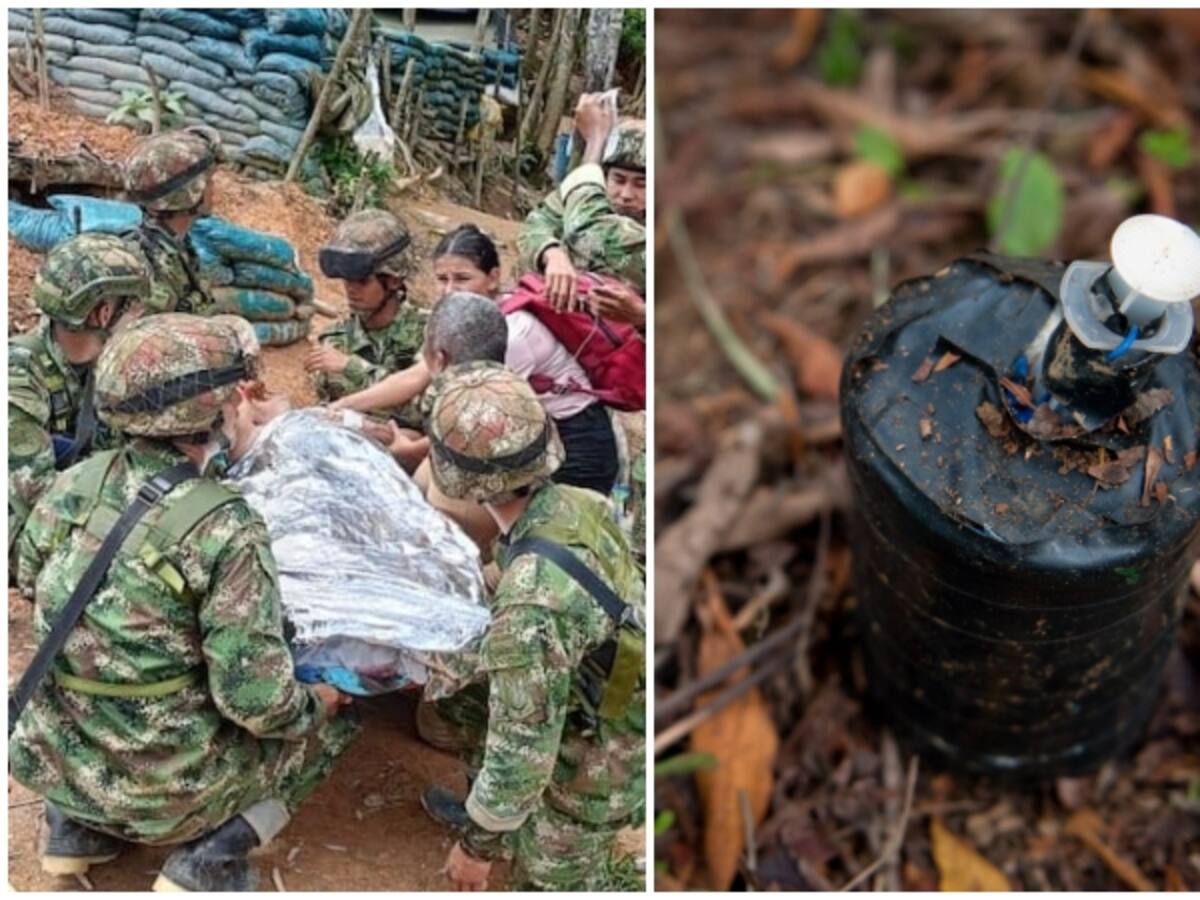 Concejal de Argelia, Cauca pierde su pierna derecha por una mina antipersonal de disidencias