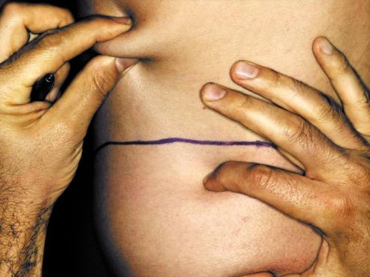 En Pasto una jóven estuvo a punto de morir en clínica estética de garaje
