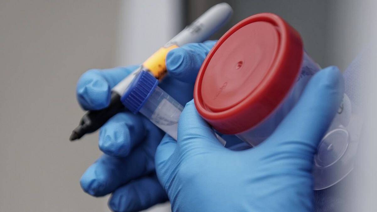 Minsalud anunció Plan Piloto en Palmira para detección de casos de covid-19
