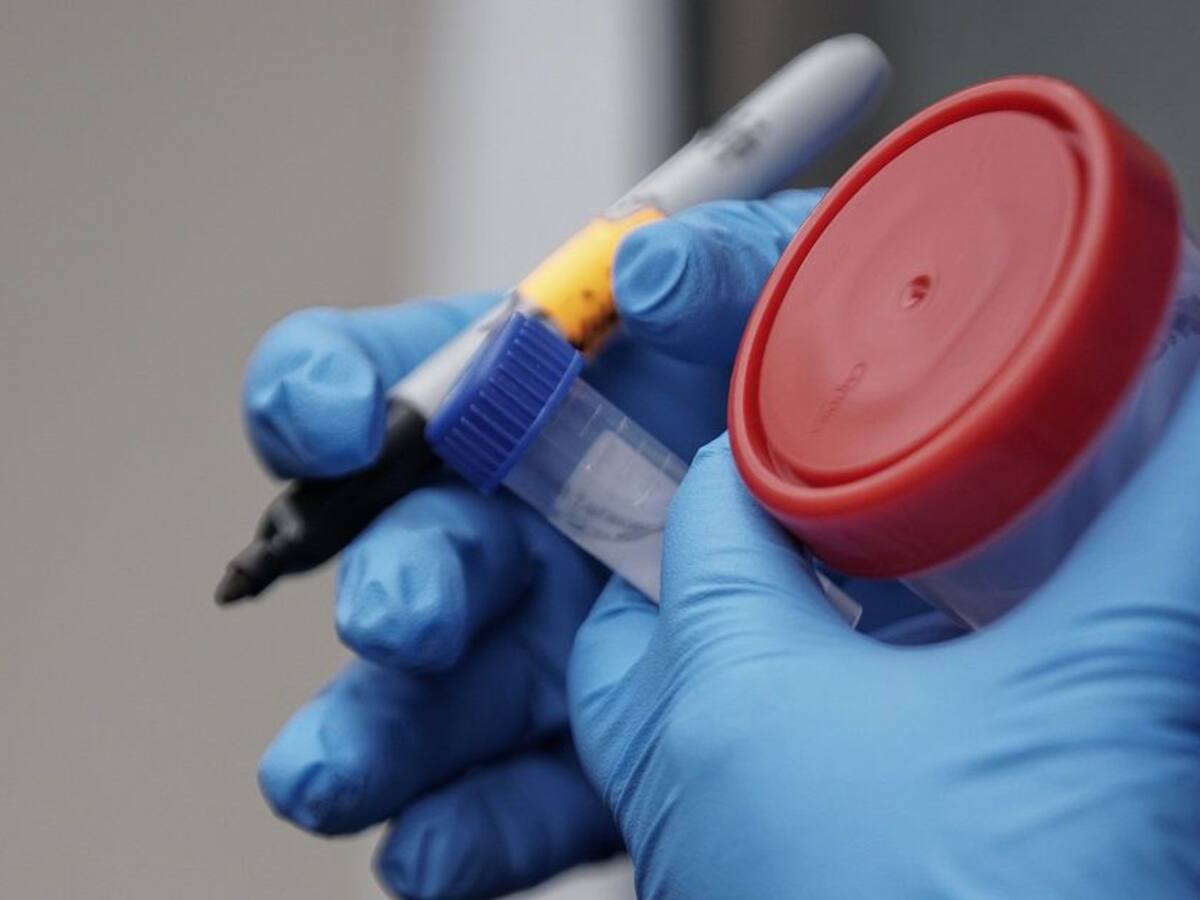 Minsalud anunció Plan Piloto en Palmira para detección de casos de covid-19