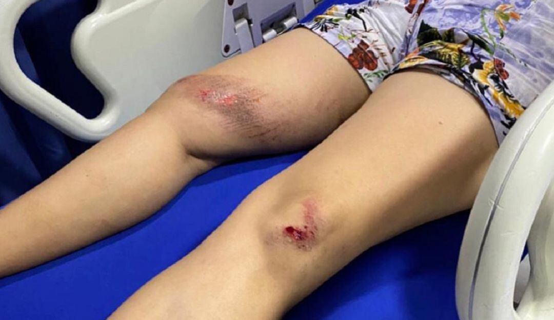 La víctima quien tiene múltiples lesiones en diferentes partes del cuerpo, se movilizaba en un “colectivo” con tres hombres.