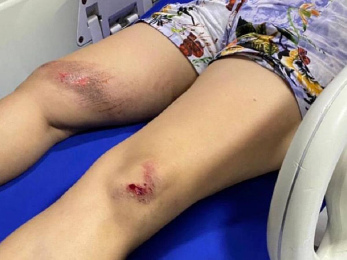 Mujer se tiró de un vehículo tras presunto intento de rapto en Cartagena