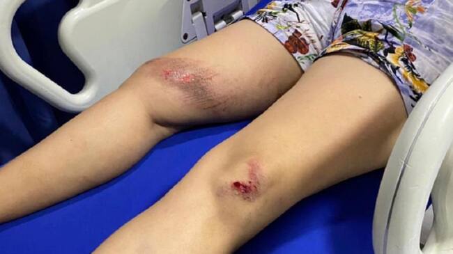 La víctima quien tiene múltiples lesiones en diferentes partes del cuerpo, se movilizaba en un “colectivo” con tres hombres.