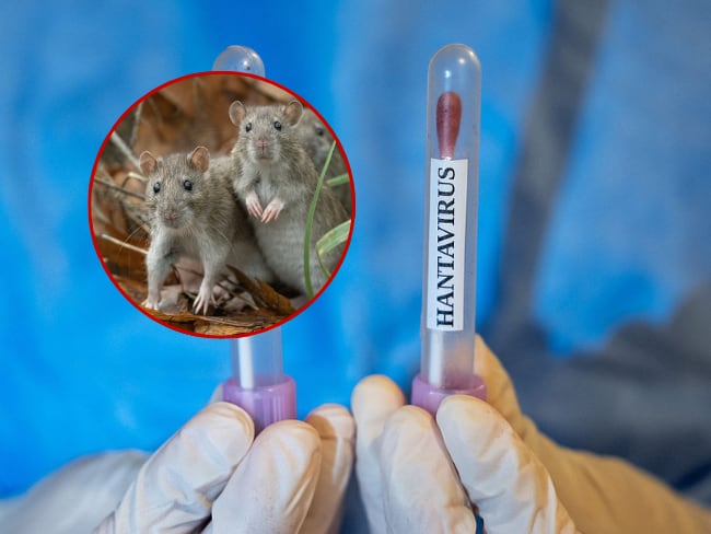 Hantavirus: Bogotá mantiene estricto seguimiento epidemiológico ante panorama internacional. Getty Images.