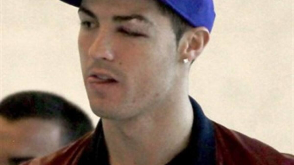 Por tener mareos y trastornos en su visión, Cristiano Ronaldo no jugará esta semana con Portugal