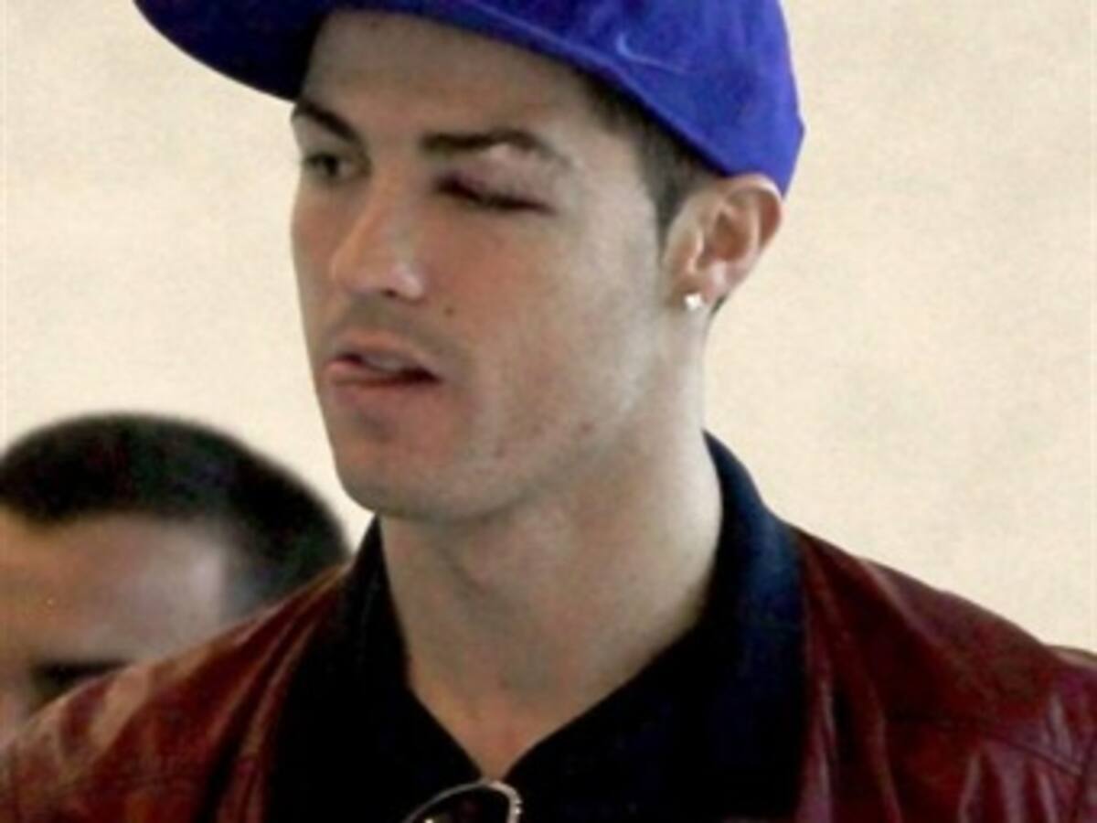 Por tener mareos y trastornos en su visión, Cristiano Ronaldo no jugará esta semana con Portugal