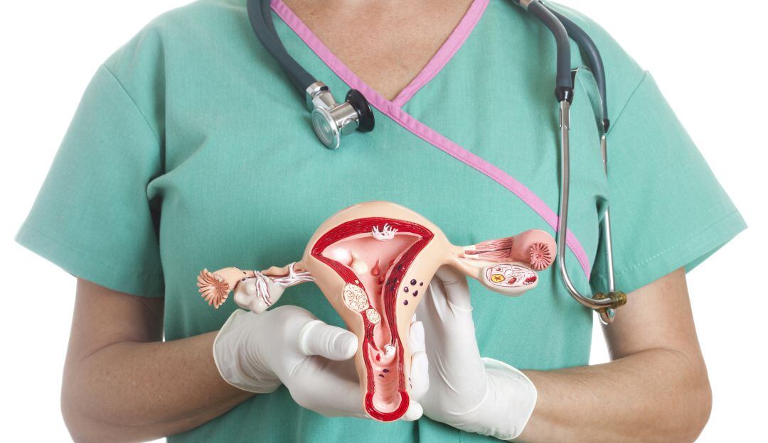 Cáncer cuello uterino