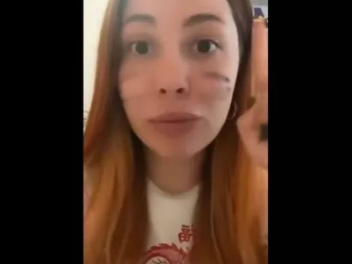 Se cree cebra y está indignada porque no la aceptaron en refugio