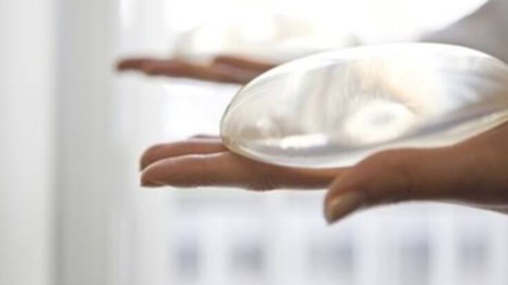 Todas las prótesis PIP eran malas: Agencia francesa de productos de salud