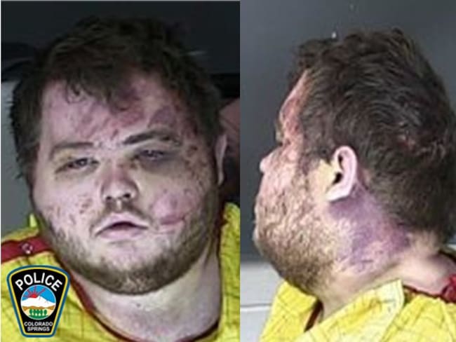Anderson Lee Aldrich de 22 años, acusado de asesinar a 5 personas en un bar gay en Estados Unidos. Foto: Colorado Springs Police
