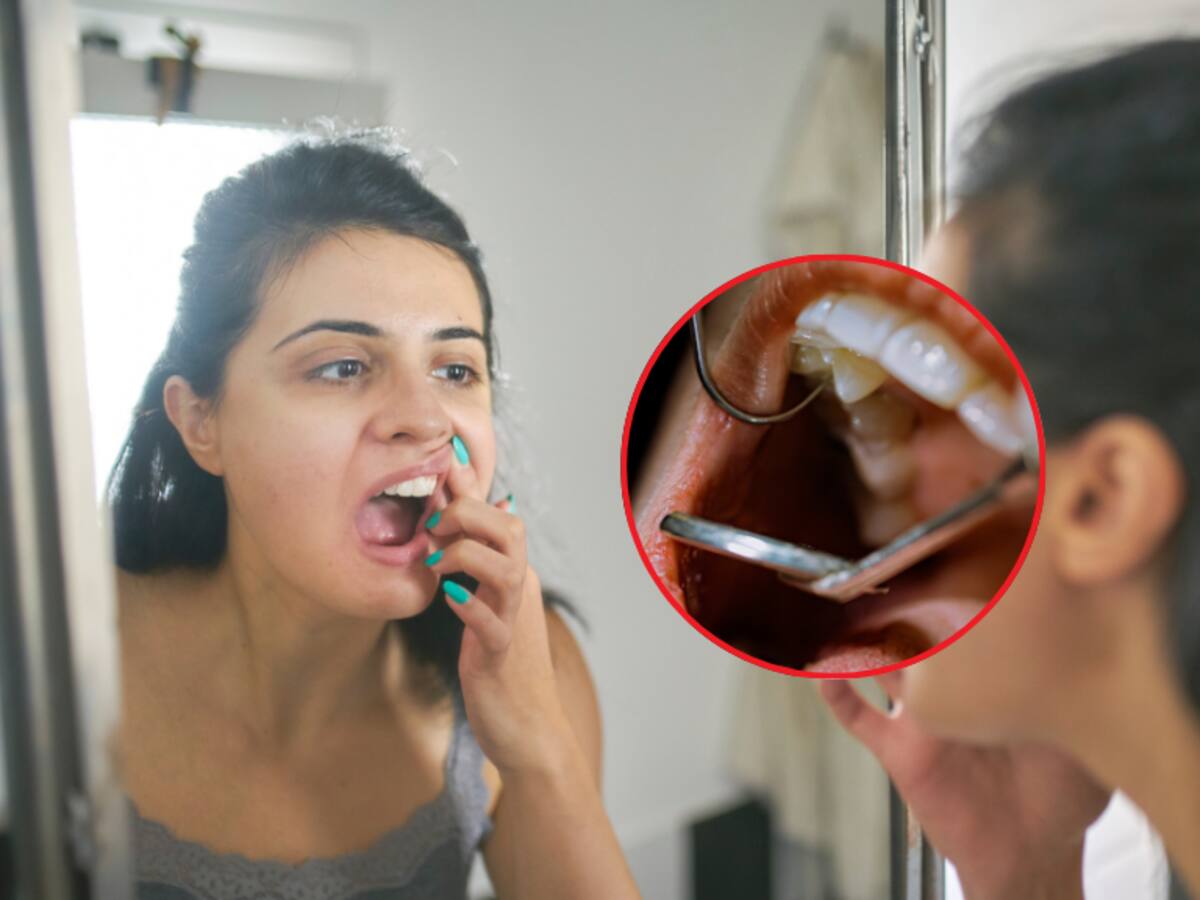 Remedio casero y efectivo para quitar y desmanchar el sarro de los dientes, según dentistas