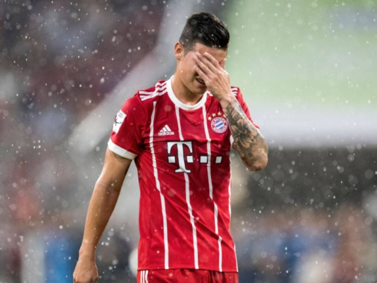 Bayern no contará con James por la próximas semanas