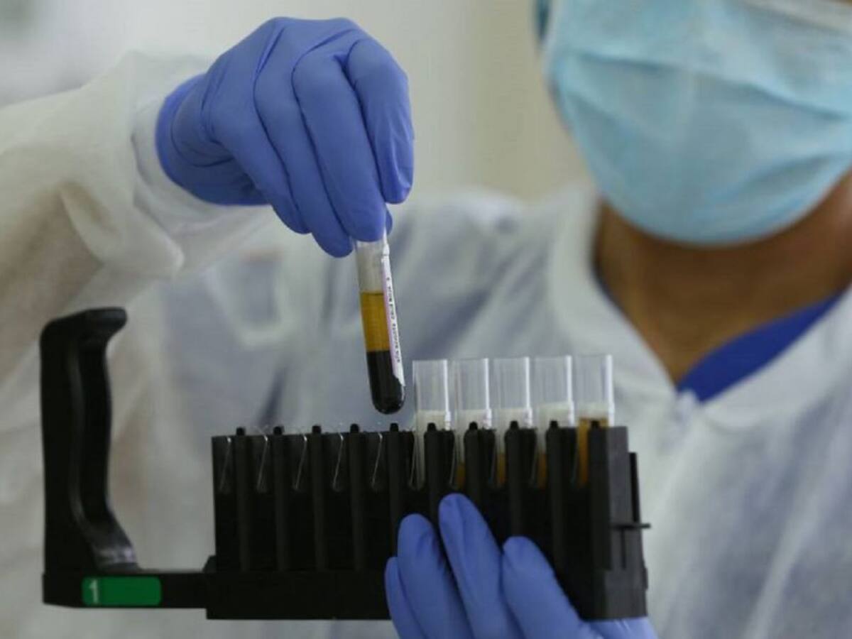 Coronavirus en Cartagena: 83 nuevos casos y seis fallecidos