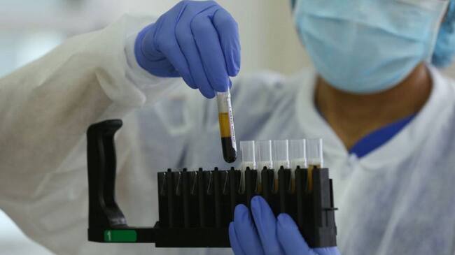 La cifra de pacientes fallecidos en Cartagena aumentó a 1.034