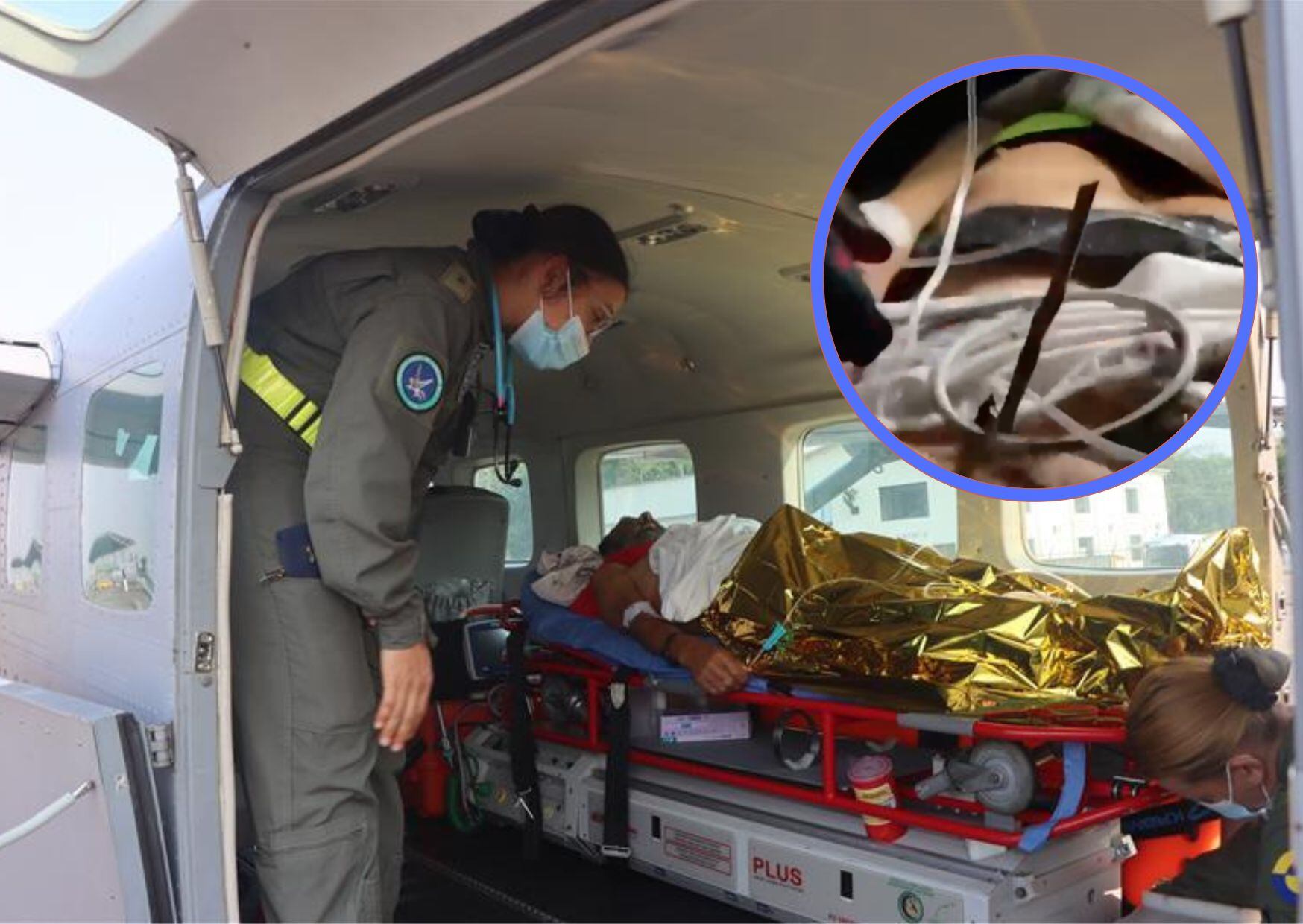 Fuerza Aérea rescató a hombre que fue atacado con flechas en Vichada. Cortesía: FAC.