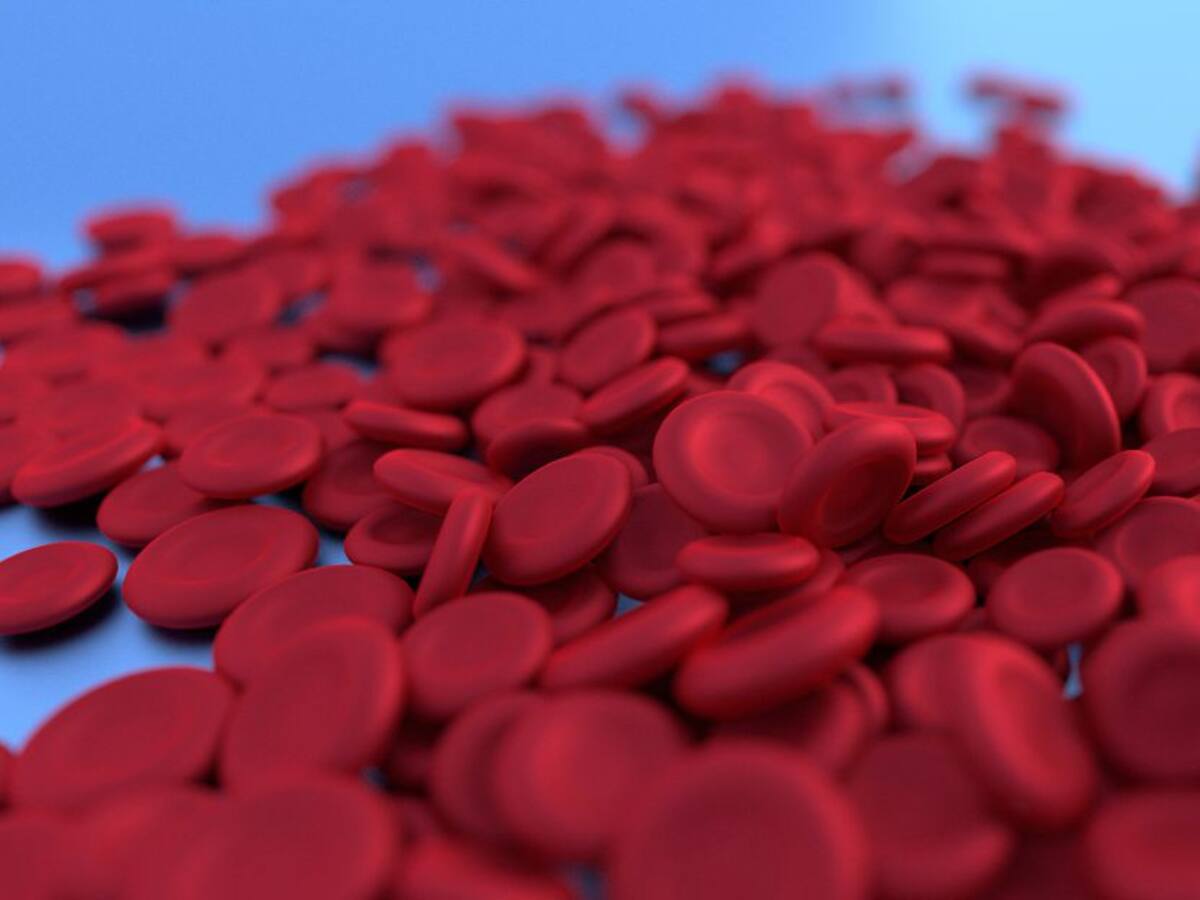 ¿Qué es la anemia de células falciformes?