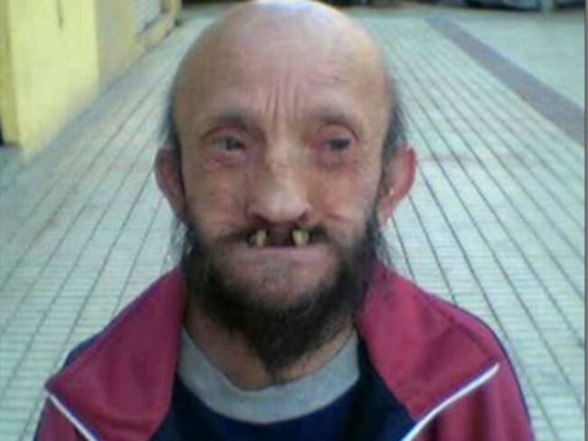 Exitosa inscripción para el reinado de los feos en Medellín