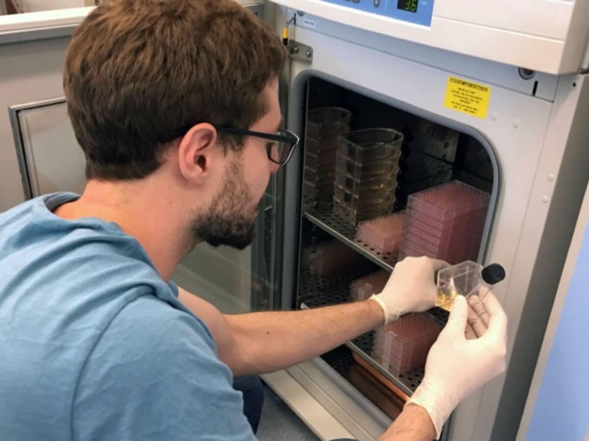 Más de 11.000 personas diagnosticadas con linfoma en Colombia