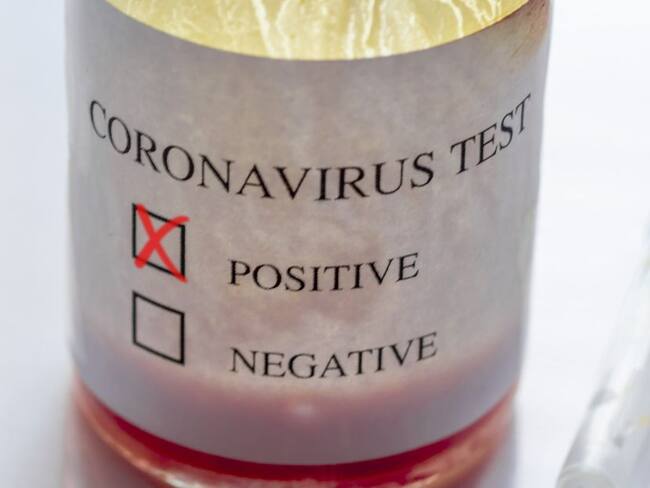 Segunda muerte por COVID-19 en Nariño