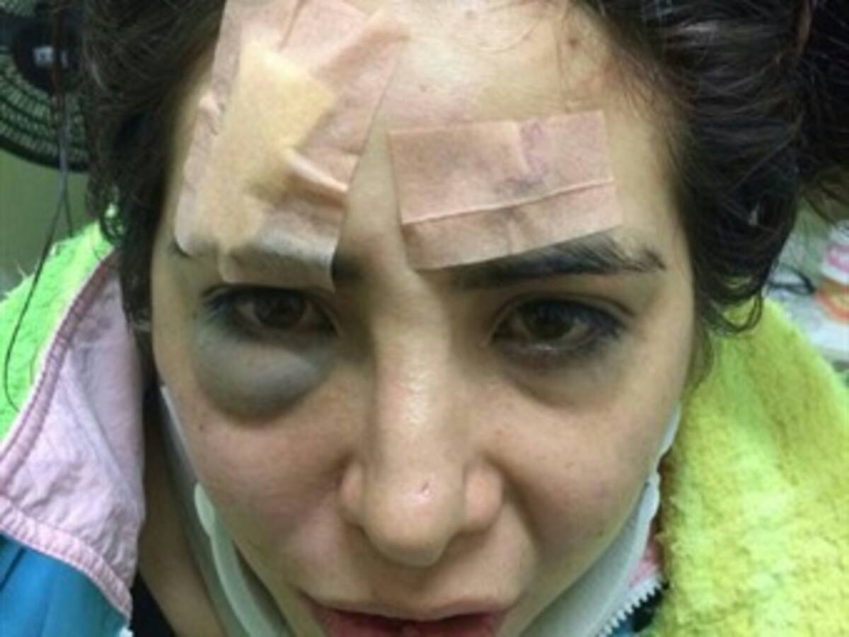 Procuraduría inicia investigaciones por brutal ataque a mujer en Boyacá