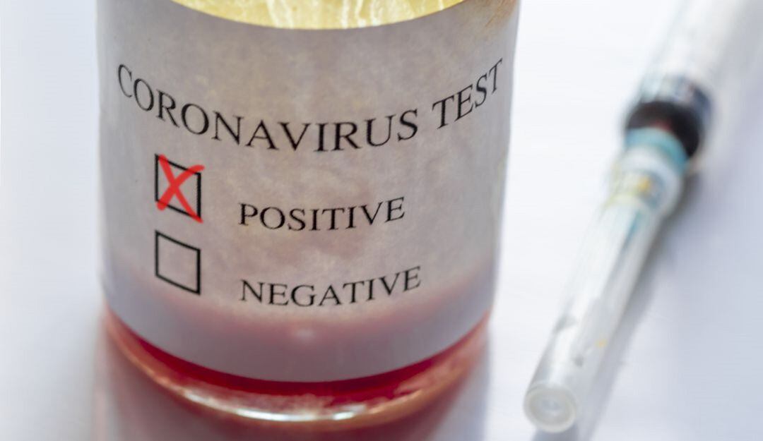 Casos positivos de COVID-19